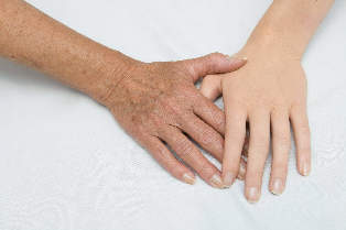 Rejuvenation of the skin of the hands