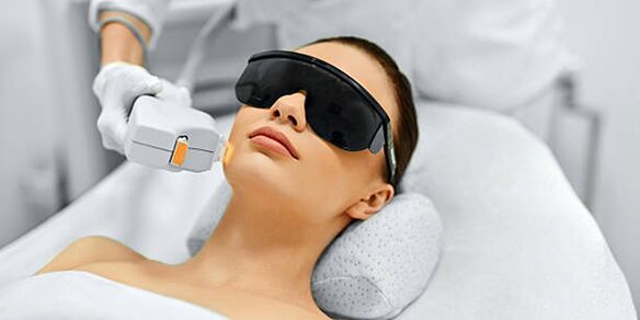 Laser procedures for skin rejuvenation