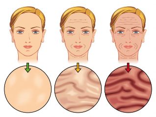 The stage of skin aging